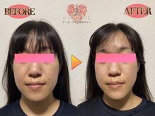 ヴィオーデ 弘前店/小顔、リンパ、ヘッドスパ、整体