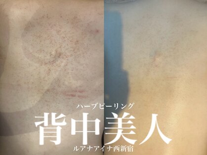 ルアナアイナ(Luana Aina)の写真