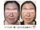 越前屋の写真/敏感肌・トラブル肌・赤ら顔も！刺激ない施術で人生最高の肌へ導く肌蘇生エステ（coming soon!)