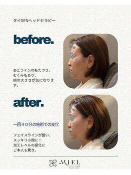 ミエル(MIEL)の写真/大阪市内当店のみ【タイSENヘッドセラピー】で眼精疲労や脳疲労による滞りをなくし、自律神経まで整える♪