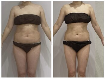 ルポーゼ(Repose)/