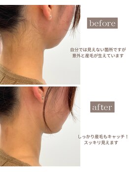 サロンドベルム(Salon de BELME)/シュガーリング:before/after
