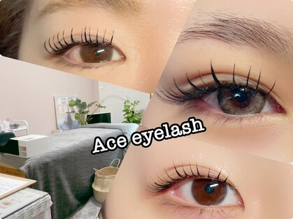 エース(Ace)の写真