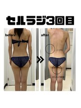 サロン叶(kanau)/頑固なセル脂肪撃退