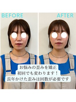 優頭(yuzu)/歪みの放置は良くないですよ！