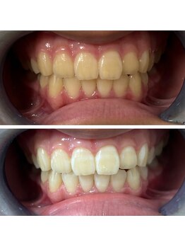 コトハ/お子様にも施術可能