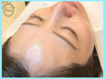 ハーブピーリング 名古屋/ツヤ肌爆誕♪　韓国女優肌♪