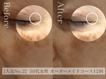 ディレイア ザ コスメ 有楽町マルイ店(direia the cosme)/小じわ/しわ/月1～2回［有楽町］