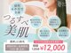 ローズドゥシャロン(Rose de CHALON)の写真