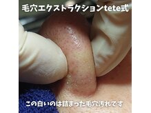 リラクシア 登別店の雰囲気（毛穴が気になる方は【いちご鼻改善☆白玉フェイシャル】を！）