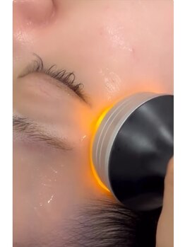 スターチス(Statice)/EMS