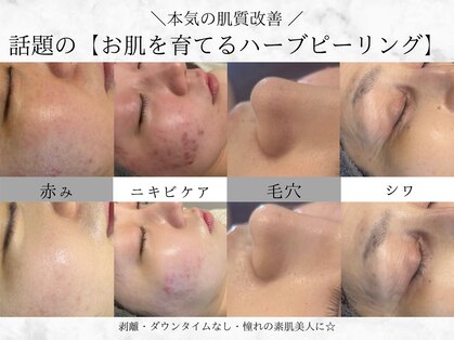 モナート ネイル(Monart)の写真