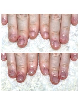 グレースレディ/(深爪/長さだし/フィルイン/)