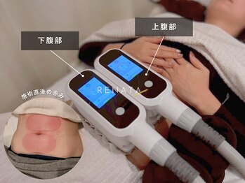 レナータ 池袋店(RENATA)の写真/【都度払いOK】人目を気にせず広々個室で贅沢な至福の時間を・・・★「RENATAトップクラスエステ６店舗へ」