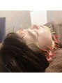 ルディア 堂島店(ledia)&nbsp;美容鍼は施術するのも受けるのも大好きです。美容鍼/美容鍼灸/