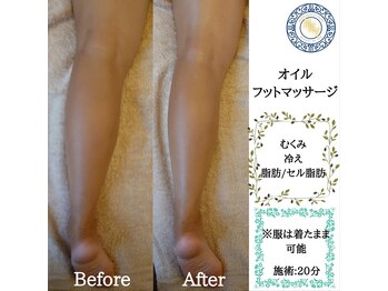 RKY/むくみ・冷え・脂肪/脂肪セル