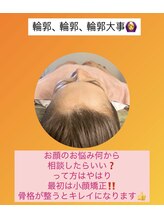 顔凛(カオリン)/オデコも丸くなる小顔矯正