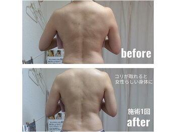 紬(TSUMUGI)/コリが取れるとしなやかな身体に