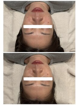 アメリオレ(ameliorer)/小顔矯正&ヘッドスパ