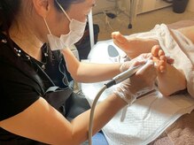 ドクターネイル爪革命ふわら