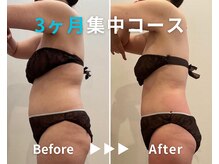 エピデリ 福岡大濠(EPI de RIZ)/【痩身/ダイエット】３ヶ月集中