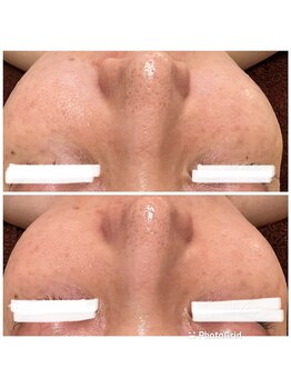 private salon Ponola【ポノーラ】/カーボキシー