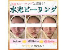 ラウレア(Laule'A)の雰囲気（私史上最高の理想のちゅるんちゅるんな韓国女優級うる艶美肌へ♪）