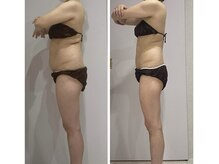 ルポーゼ(Repose)/