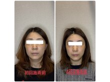 小林整骨院 本町/【たるみ改善に特化】