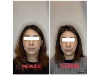 小林整骨院 本町/【たるみ改善に特化】