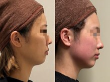 ジェジル 表参道(JAEJIL)/Before After