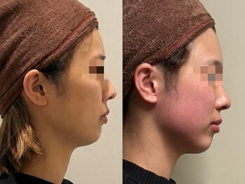 ジェジル 表参道(JAEJIL)/Before After