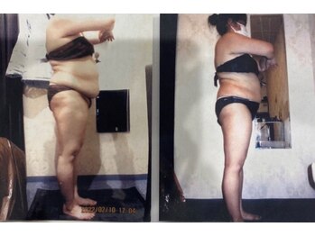 クイーン 札幌駅前店(Queen)/お客様 ビフォーアフター(3)