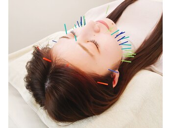 おもいやり鍼灸治療院 モーイ(mooi)/美容鍼でリフトアップで小顔に♪