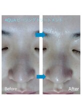 ルアナ(Luana)/毛穴ディープクレンジング♪