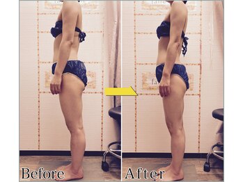 整体 美容サロン フェールラヴィ/【整体+痩身】