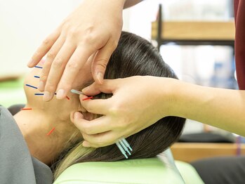 アスミルはり灸接骨院 春岡通店/美容鍼もあります♪