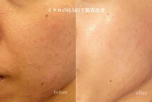 グリッター(GLITTER)