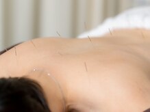 溝口鍼灸整骨院