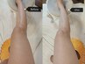 NEW★【美容業界初】全身美白マシン導入　体験価格/初回限定　60分　¥5000