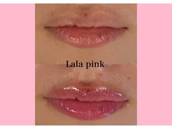 ハーシークレット(Her secret)/ララピンク・メラニンケア