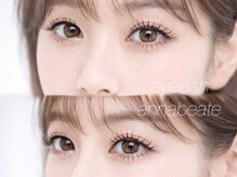 アンナボーテ(Anna beate)