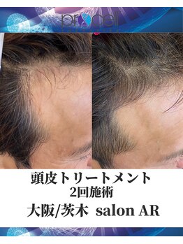 メンズサロンアール(AR)/プロセルセラピーズ