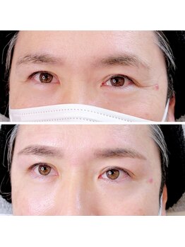 アシスティブサロン ライフ 博多竹下店(assistive salon Life)/メンズブロウ「博多・竹下」