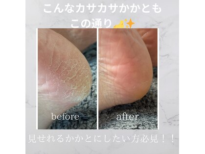 シャドウ(shadow)の写真