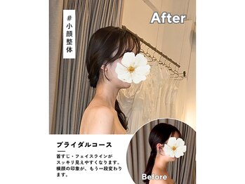 押上やまき整体の写真/骨格に合わせ姿勢改善！ドレスを着こなすように天使の羽やデコルテを輝かせるブライダル整体！！