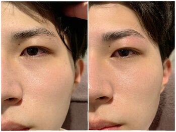 メンズスタジオ リボーン(REBORN)の写真/＜松山/脱毛＞毛穴の開き・汚れ解消【眉毛WAX＋フェイシャル洗浄】 ニキビ予防まで♪シミケアMENU も◎