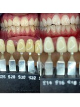 トウキョウスワーズ 池袋店(TOKYO SWRS)/#ホワイトニング #池袋 #渋谷