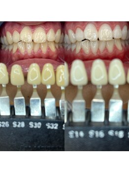 トウキョウスワーズ 池袋店(TOKYO SWRS)/#ホワイトニング #池袋 #渋谷