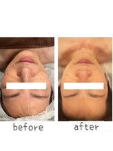 トモズサロン28(Tomos.salon.)/左右差・歪み改善！